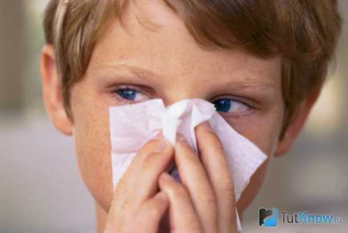 Аллергия весной: виды, симптомы, лечение