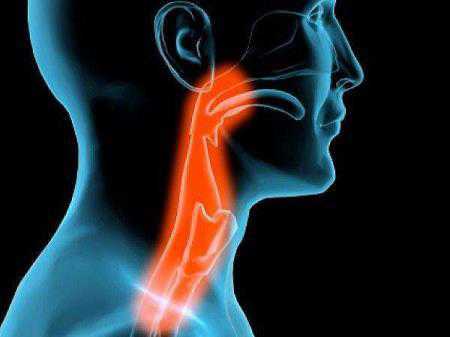 В хронической форме фарингит проявляется в виде комка в горле, когда часто возникает желание прочистить гортань, прокашляться